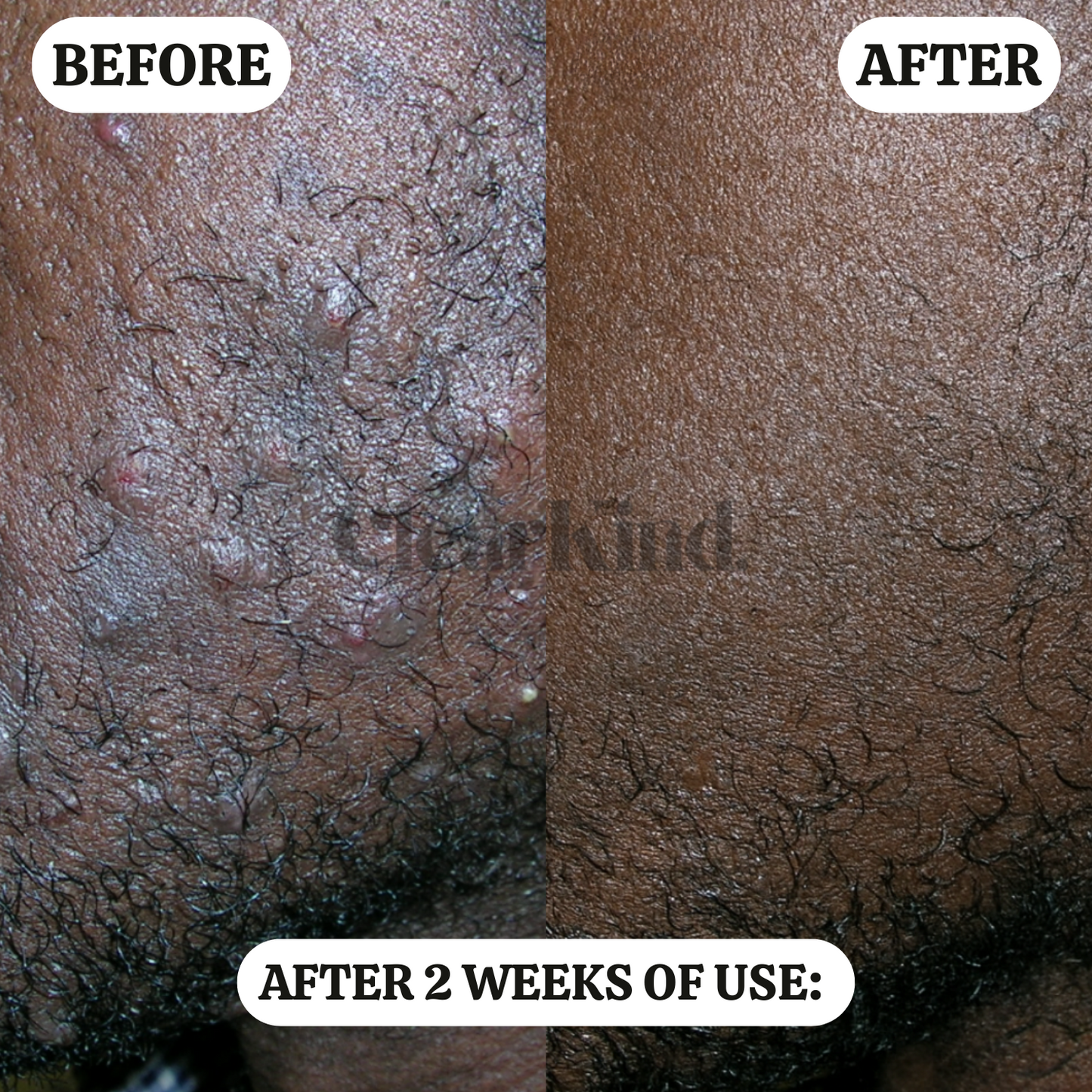 ClearKind™ The Barrier Reset Formula