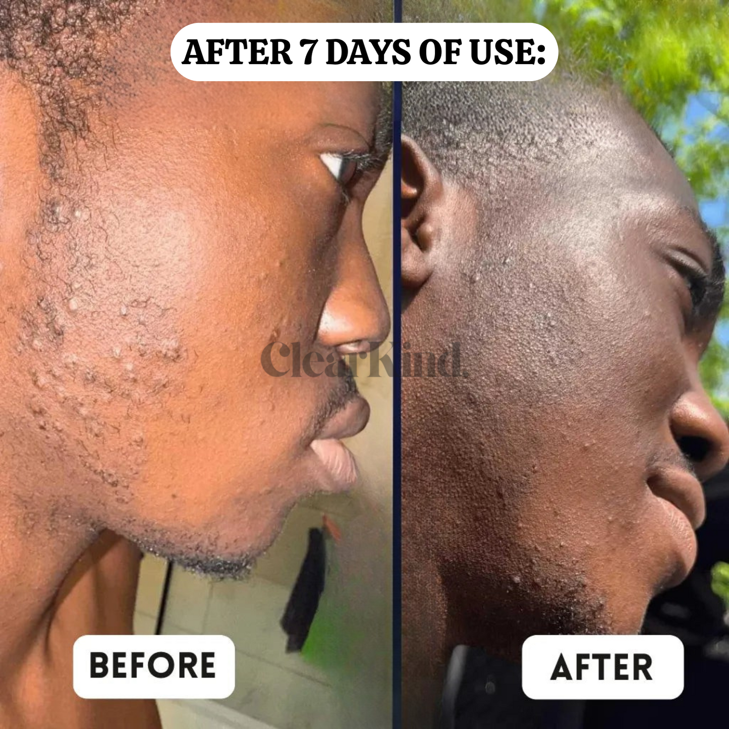 ClearKind™ The Barrier Reset Formula
